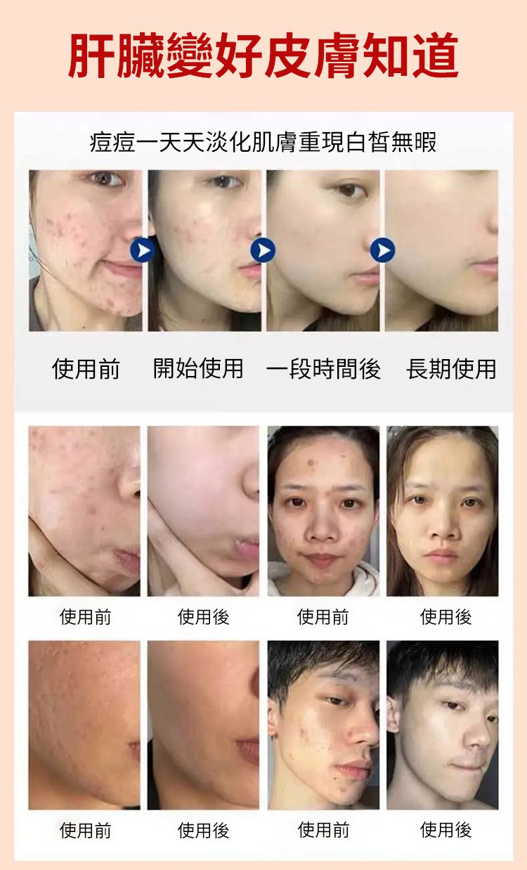 香港時珍大藥局水飛薊人參佛手貼,香港大藥房香港時珍大藥局水飛薊人參佛手貼天麻三七通絡貼雞血藤益母甘草貼6貼每盒 16 香港時珍大藥局水飛薊人參佛手貼_14.jpg