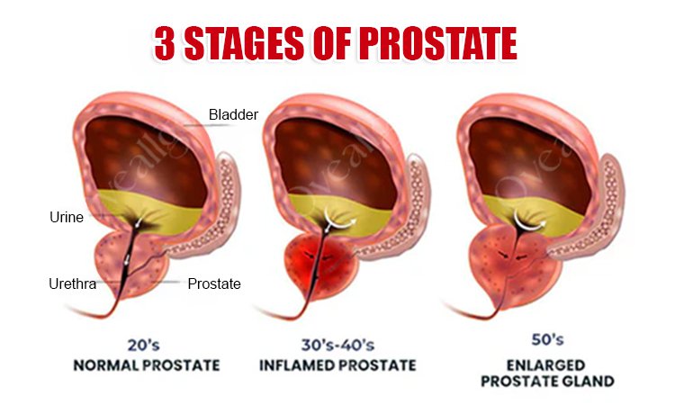 8a28c7d636fa792d85ad8021ae3a5cf6