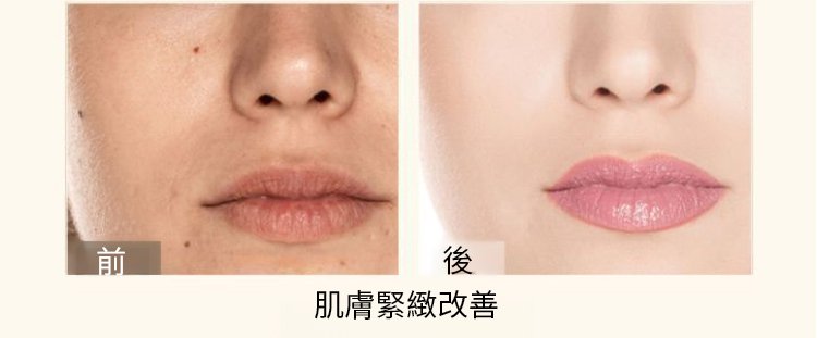 ce4a513c4c2019272eef88f0acec6950 【秒去皺紋】NUOSILI依克多因逆齡精華