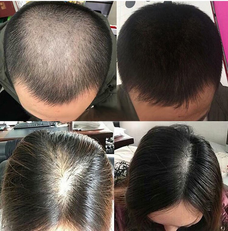 冬蟲夏草控油洗髮精 10 8c5e864565172e9378970911bcea19d4 冬蟲夏草控油洗髮精