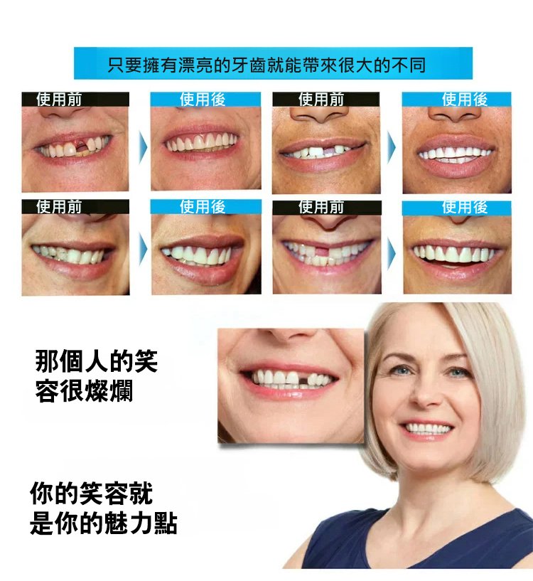 矽膠假牙套