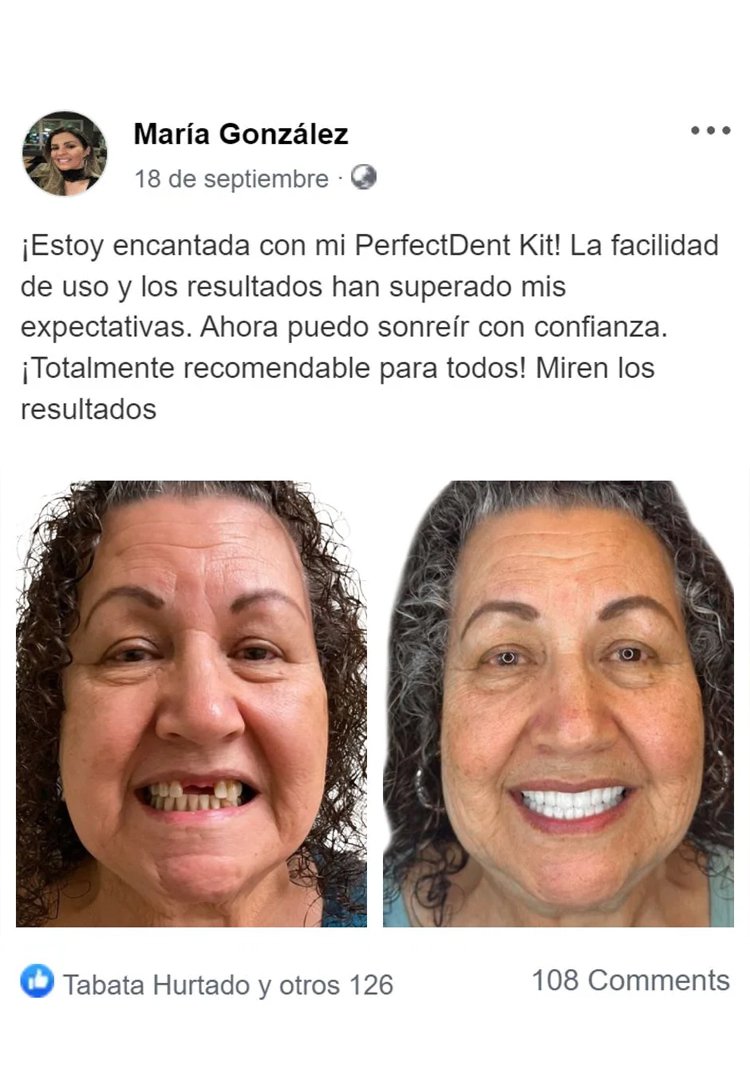64271cf52df9f9d109a68d611a40948a MOON SMAIL Cosmetic dentures