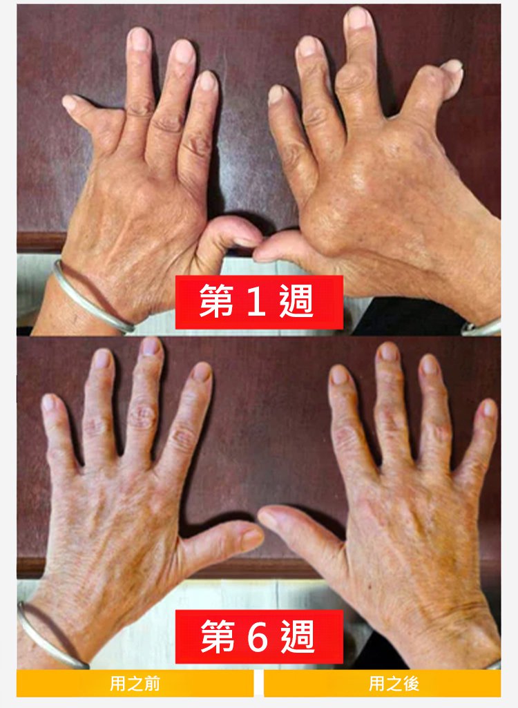 塑膠時光氨糖軟骨素鈣膠囊,金奧力牌同款塑時光同款氨糖軟骨素鈣膠囊塑時光40粒每瓶 23 f810eaa44a22cdbf9093ae226b3eb1ed 塑膠時光氨糖軟骨素鈣膠囊