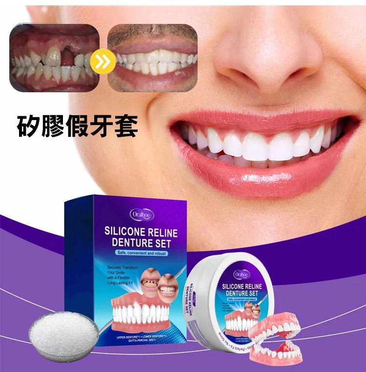 矽膠假牙套