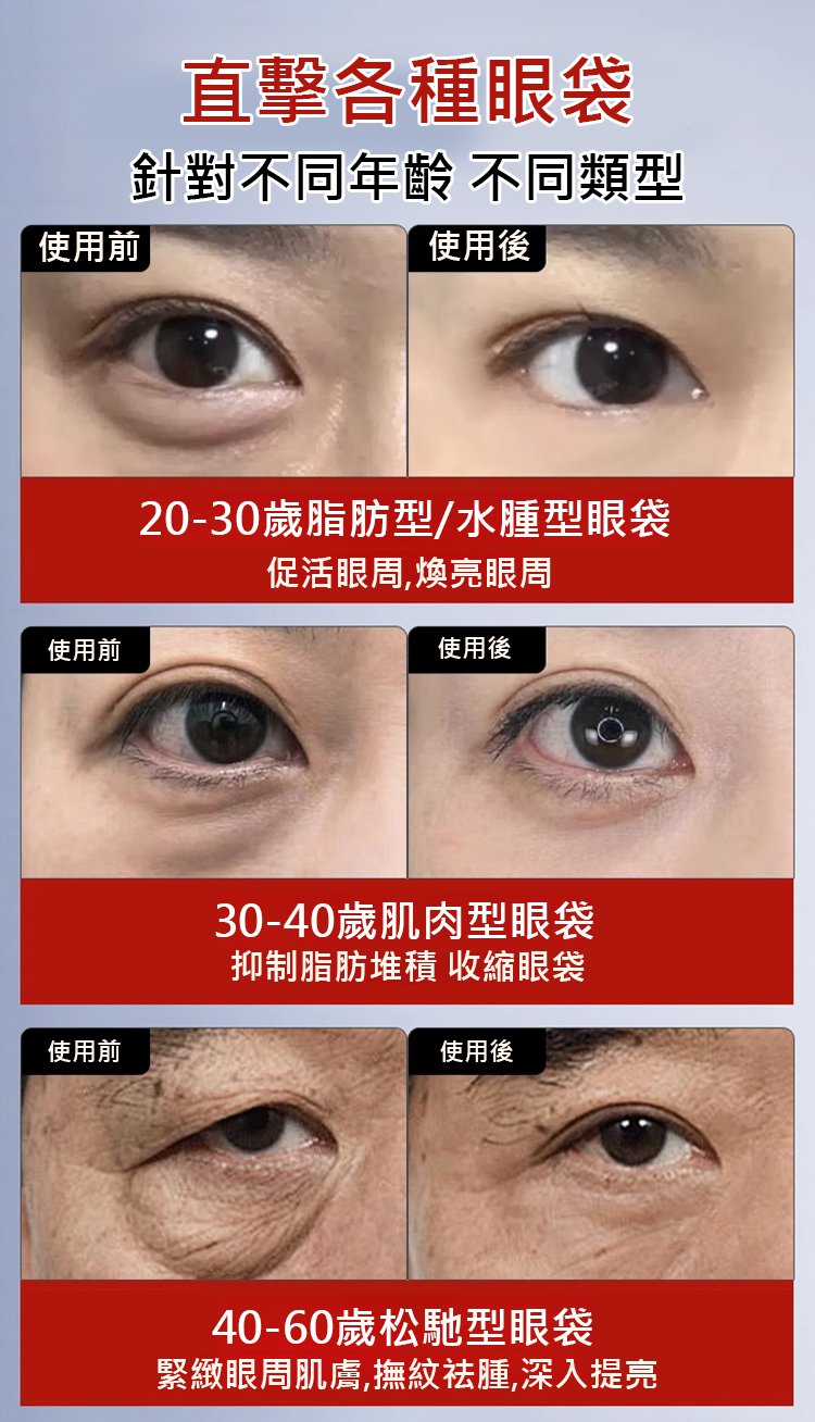 415d914cc0567f081efb4ea7eef992c3 【專攻眼部問題】香港大藥房草本眼袋膏