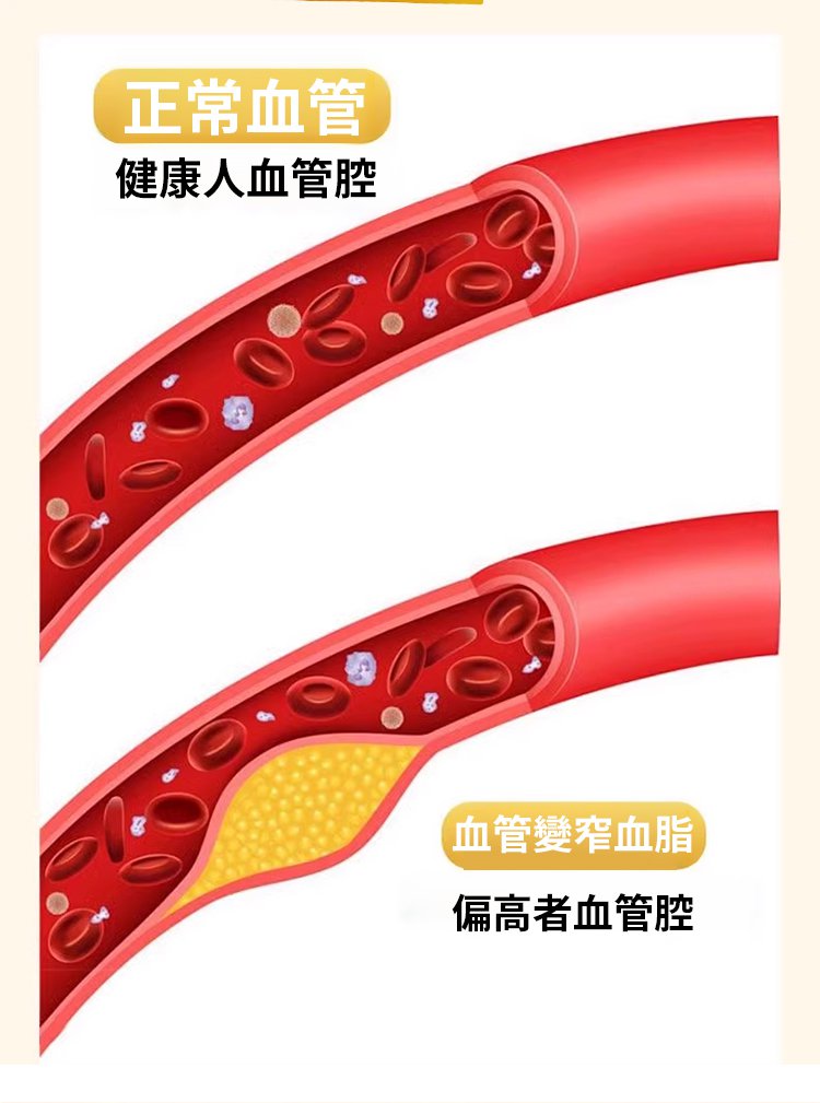 李時珍亞麻籽油軟膠囊,芙順堂百合康牌亞麻籽油維生素E軟膠囊輔助降血脂守護血管李時珍10粒每盒 21 fc6f2b40660afb31e73050cdfb1d90e7 李時珍亞麻籽油軟膠囊