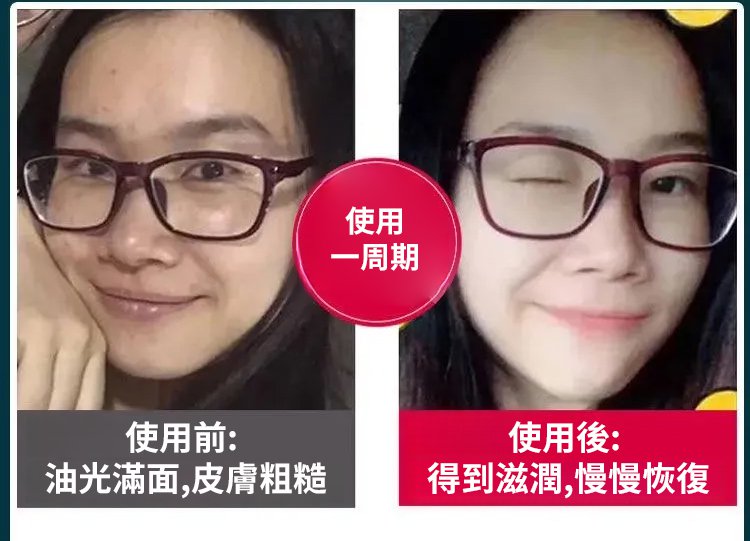 元氣茯苓八珍足貼,李時珍老北京元氣茯苓八珍足貼 睡眠貼艾灸貼腳底貼溫灸貼艾草足貼30貼每盒 32 c8978513fd61215ed6da56ea10df3668 元氣茯苓八珍足貼