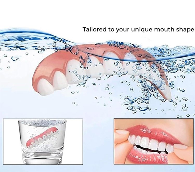 7fa25fab9bafa86773c8ee7ec9240aa7 MOON SMAIL Cosmetic dentures
