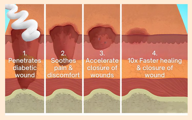LOVILDS™Diabetic Wound Treatment Cream