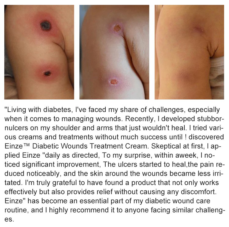 LOVILDS™Diabetic Wound Treatment Cream