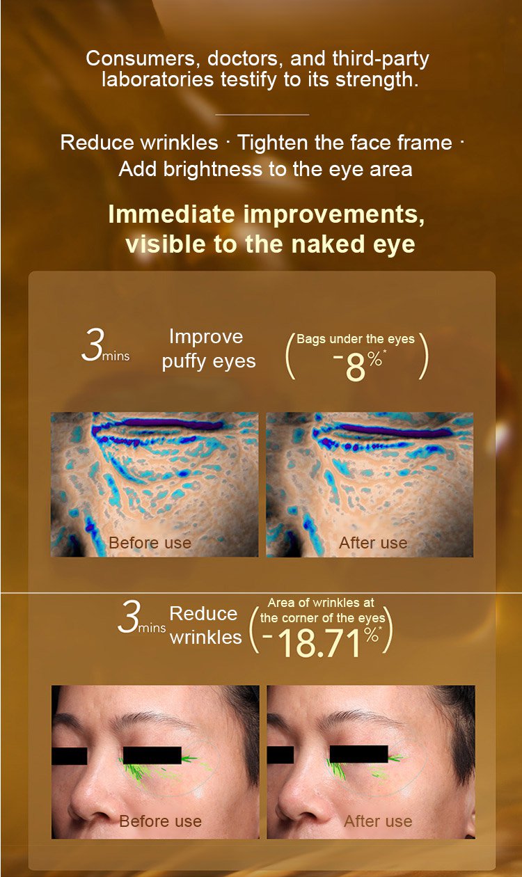 49ae8448a7b3ac50d21e1d96fa8e1d5d Eye SPA Lutein Firming Essence Oil