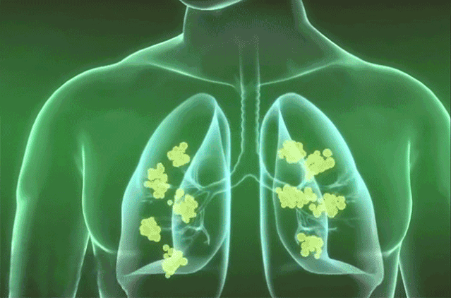 金奧力牌硒含片 15 d187aae6c4b9b813438af48aca7b0483.gif