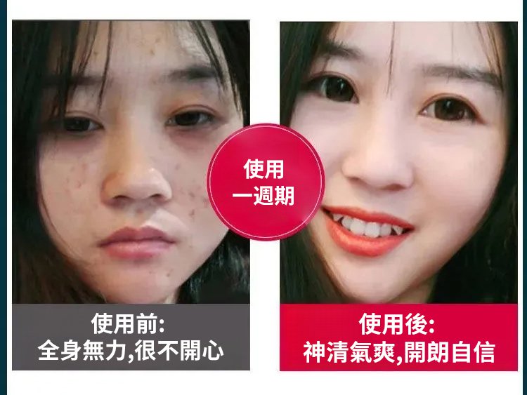 元氣茯苓八珍足貼,李時珍老北京元氣茯苓八珍足貼 睡眠貼艾灸貼腳底貼溫灸貼艾草足貼30貼每盒 33 a1827a2bfc3dc01f098ca3fc0b2c08d8 元氣茯苓八珍足貼