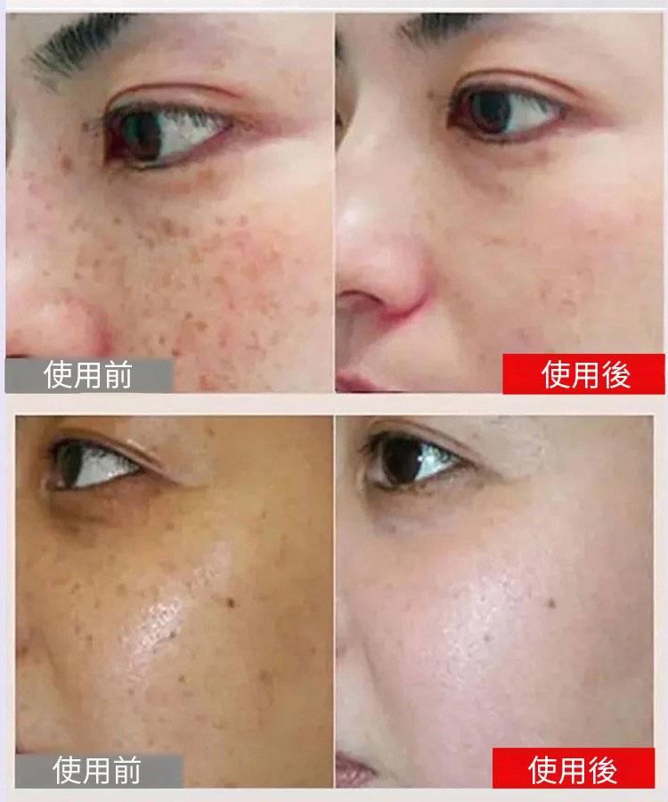 斑斑噴577 18 78609cd5ac5ff4f41da68fea7e58834c 斑斑噴577