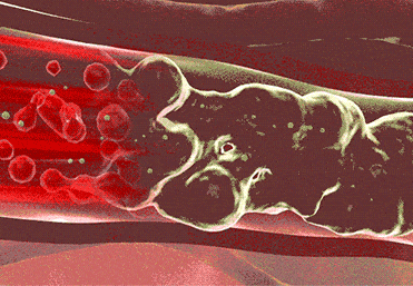 元氣茯苓八珍足貼,李時珍老北京元氣茯苓八珍足貼 睡眠貼艾灸貼腳底貼溫灸貼艾草足貼30貼每盒 24 ad3aaca93707b3080606439ca34d459b.gif