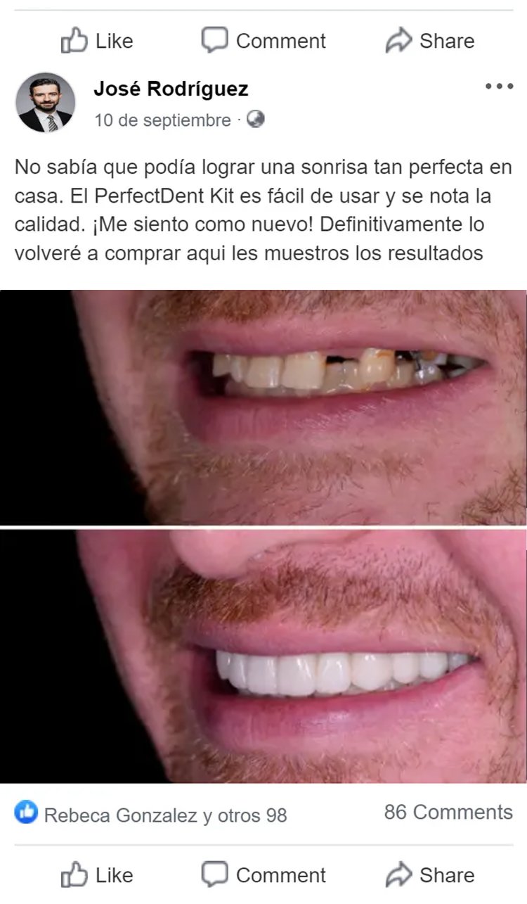 cab9294d4ebcac00eee16e13a9a97814 MOON SMAIL Cosmetic dentures