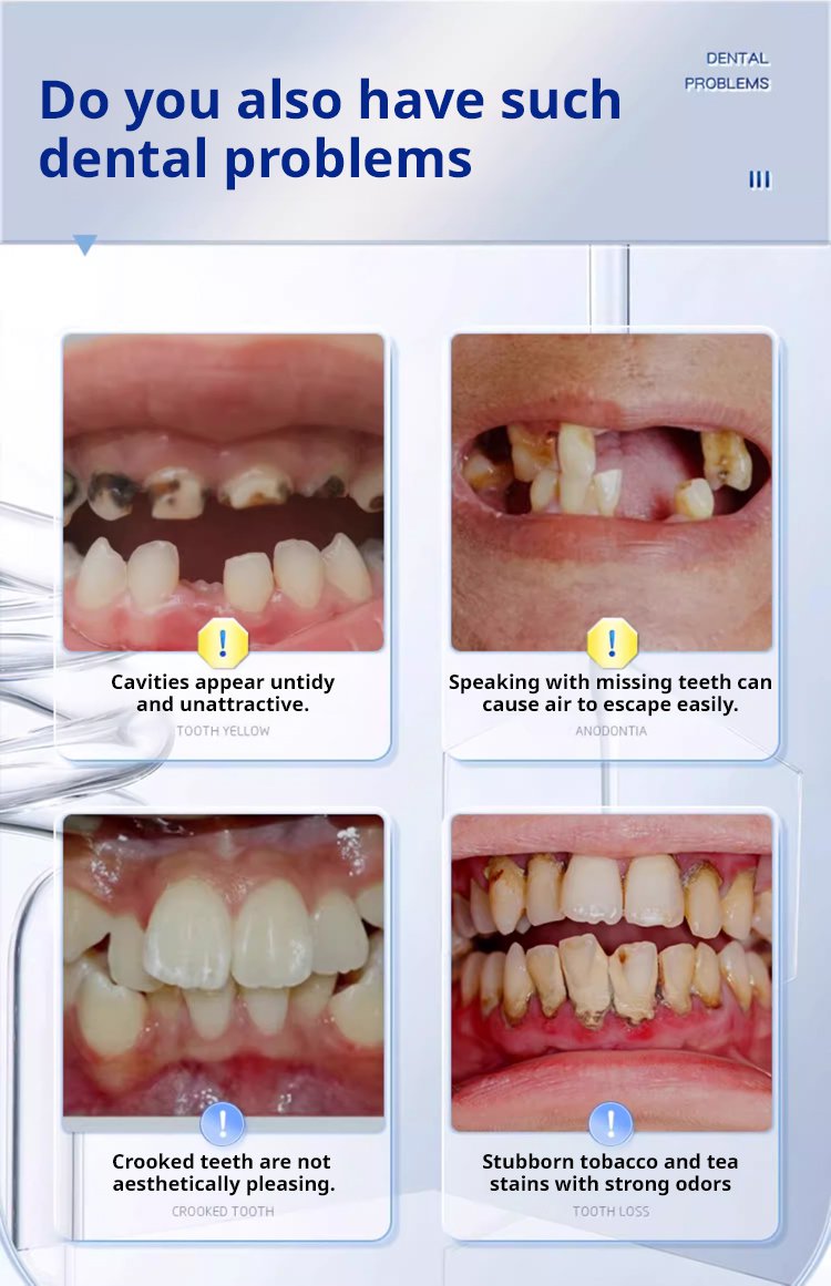 a8ce2ae8dcd4e269ef8a1d4a26c19390 MOON SMAIL Cosmetic dentures