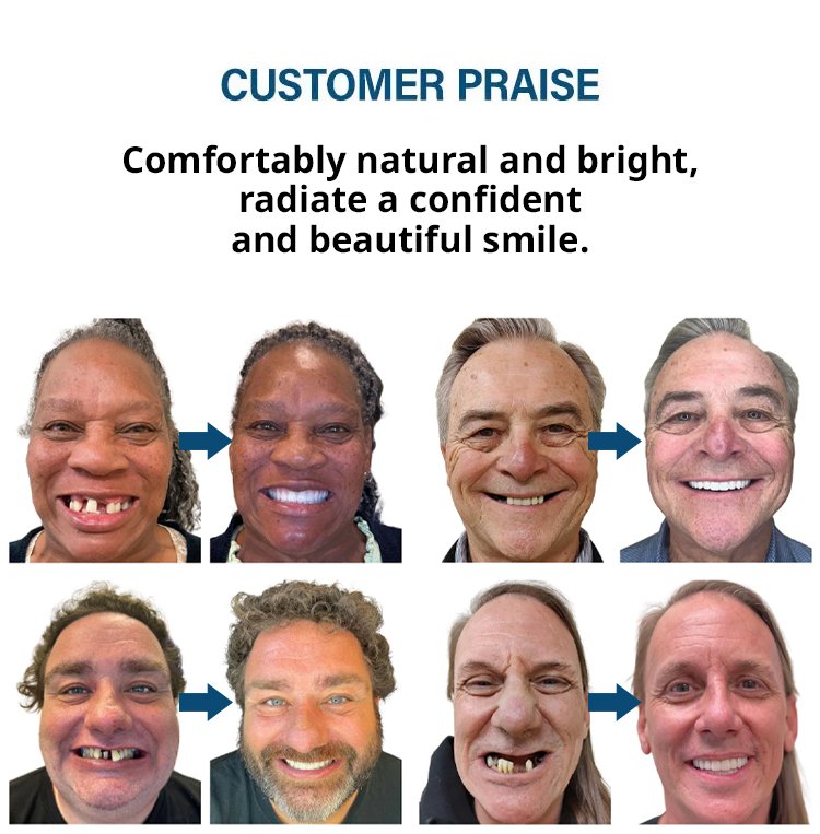 b0750c78f5e7124072335a60f9fe7c51 MOON SMAIL Cosmetic dentures