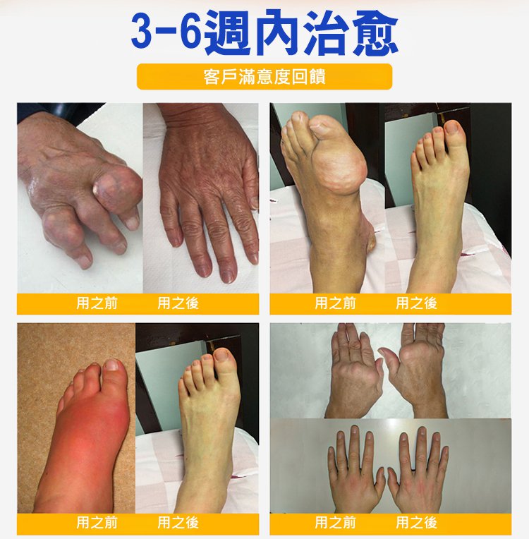 塑膠時光氨糖軟骨素鈣膠囊,金奧力牌同款塑時光同款氨糖軟骨素鈣膠囊塑時光40粒每瓶 22 3218a8dd4496aca5d20dc204f20d1038 塑膠時光氨糖軟骨素鈣膠囊