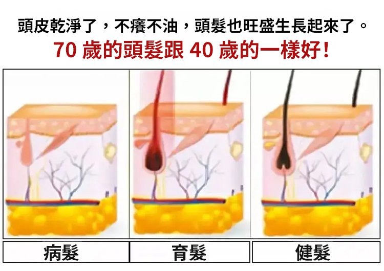 冬蟲夏草控油洗髮精 12 3457a13792005529a13df5320959ed53 冬蟲夏草控油洗髮精