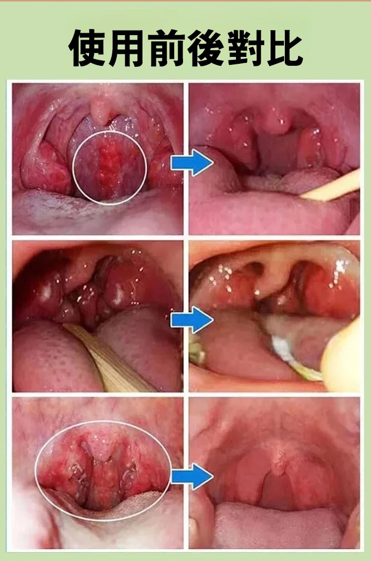 人參百合玉竹羅漢果片,趣醫森草本精華科學配比清潤護喉壓片糖果60片每瓶 22 6017cda45a72b69be3e8d3349e049c6c 人參百合玉竹羅漢果片