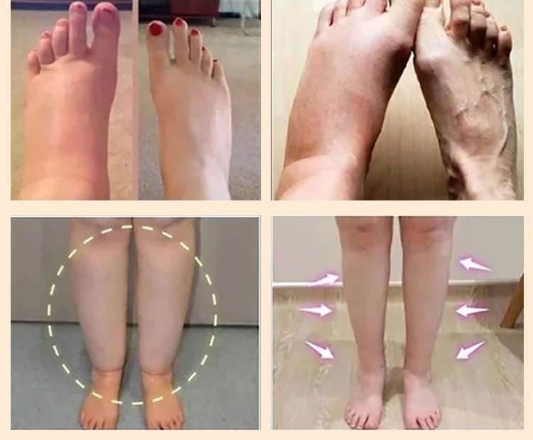 LOVILDS™Diabetic Wound Treatment Cream