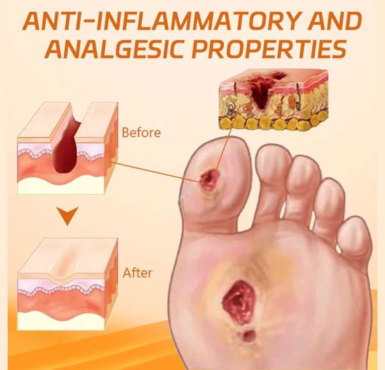 LOVILDS™Diabetic Wound Treatment Cream
