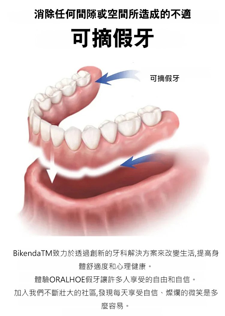 矽膠假牙套