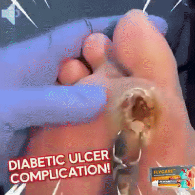 LOVILDS™Diabetic Wound Treatment Cream