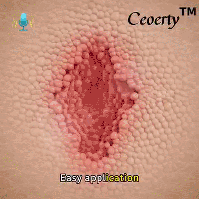 LOVILDS™Diabetic Wound Treatment Cream