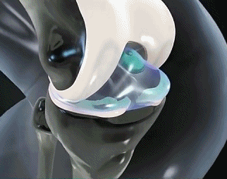 塑膠時光氨糖軟骨素鈣膠囊,金奧力牌同款塑時光同款氨糖軟骨素鈣膠囊塑時光40粒每瓶 16 5be608bac12beb18b7e3d4b11be3457f 塑膠時光氨糖軟骨素鈣膠囊