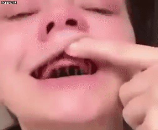 矽膠假牙套