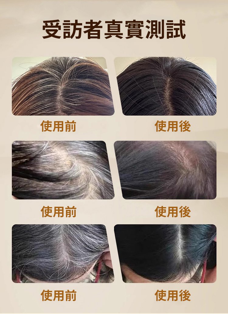 冬蟲夏草控油洗髮精 18 1a99172c7caea0f2f923598b31d05b9d 冬蟲夏草控油洗髮精