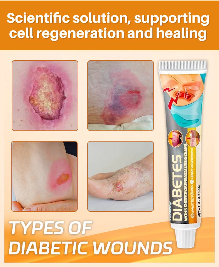 LOVILDS™Diabetic Wound Treatment Cream