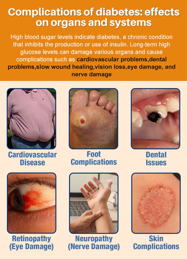 LOVILDS™Diabetic Wound Treatment Cream