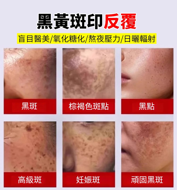 斑斑噴577 7 213ed6f32c58019c339f48083fe3ce4d 斑斑噴577