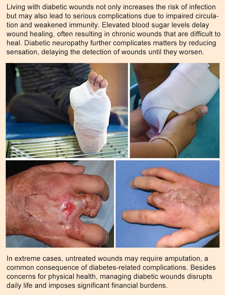 LOVILDS™Diabetic Wound Treatment Cream