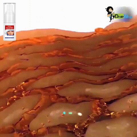 HFH-白癜风护理喷雾_9-1.gif