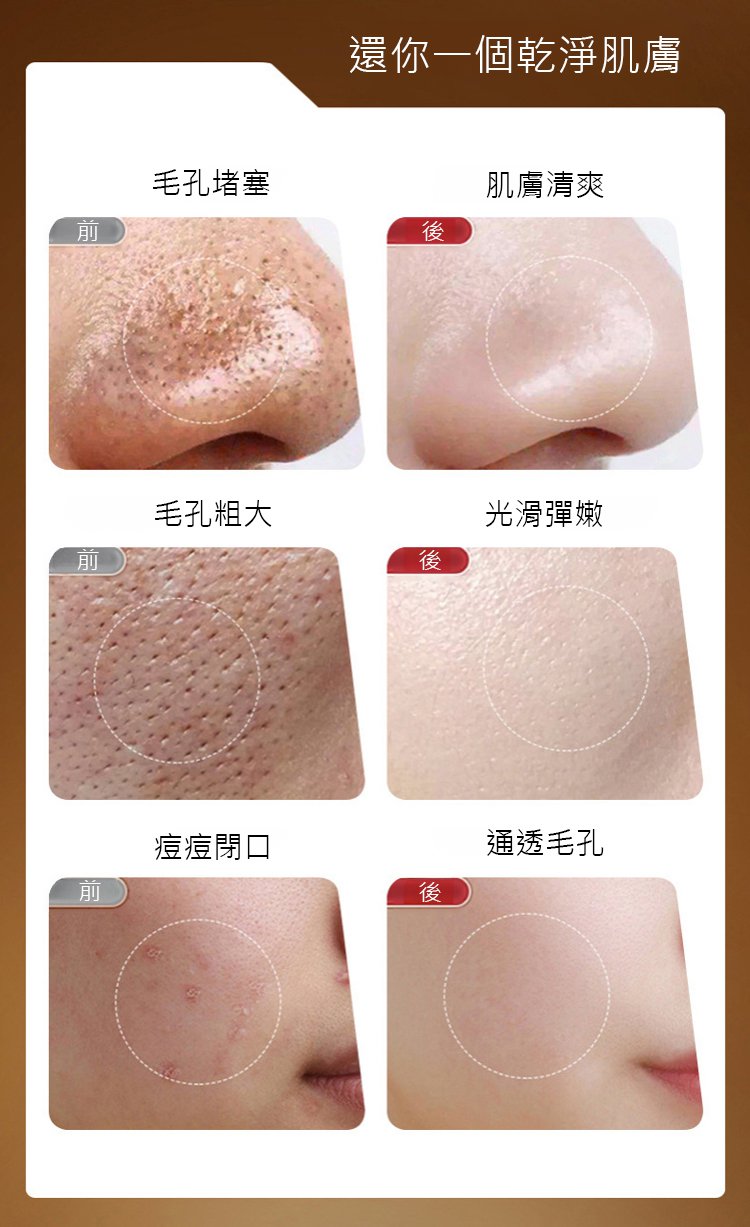 9491b27421efc5903ea72512092a2bb8 BARSE芭奢黃耆抗皺撕拉麵膜