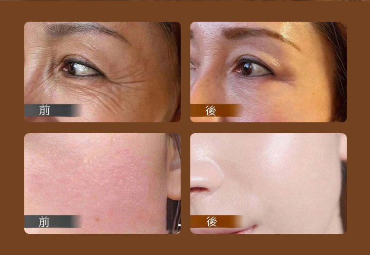 e22e27ea7e0fc303a19e2bcfd2c71197 BARSE芭奢黃耆抗皺撕拉麵膜