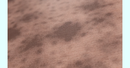 melapeel_24 (1).gif.gif