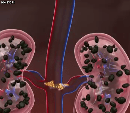 Honeycam 2025-09-20 11-23-41.gif