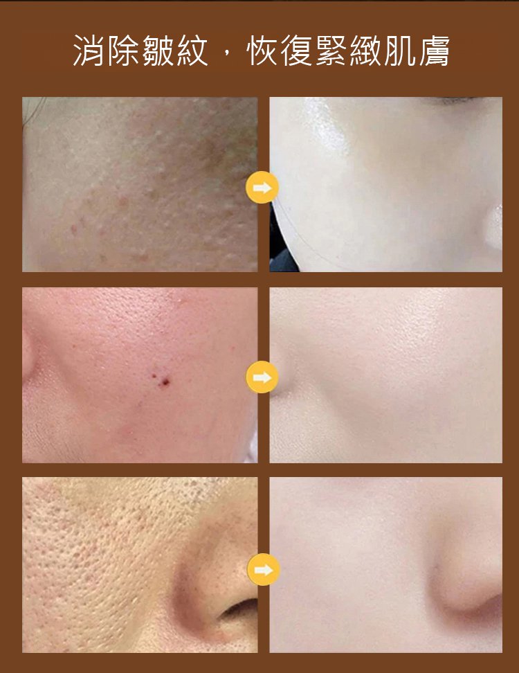 aaded3a6b3c926ceaccc4f1158f4a30e BARSE芭奢黃耆抗皺撕拉麵膜