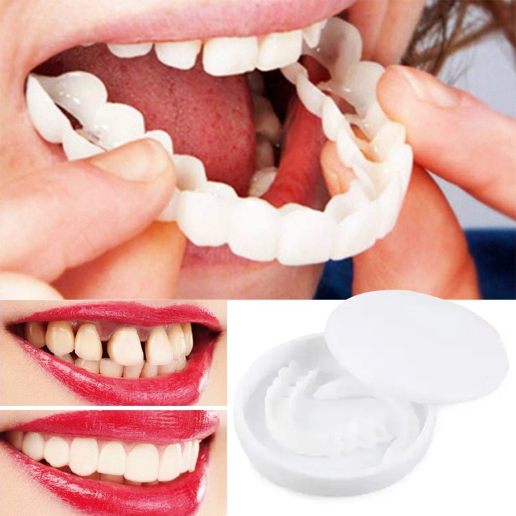 デンタルマウスピース 繰り返し使え 気付かないうちに歯列矯正 簡単な一歩で素敵な笑顔を手にしましょう Kawavyオンラインストア デンタルマウスピース 繰り返し使え 気付かないうちに歯列矯正 簡単な一歩で素敵な笑顔を手にしましょう Kawavyオンラインストア