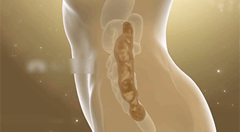 毫醫生祛濕穴位貼 13 001a567c508e014ba639ed8513775bd27011529801006319654TW2e4da3b7fbbce2345d7772b0674a318d5 毫醫生祛濕穴位貼