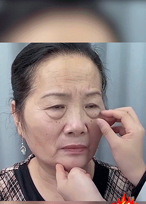 【中藥抗皺法寶】黃耆淡紋水晶眼膜貼 12 16071c3aff4b1a0b518a0bd166ce14947011281981005473130TW2c81e728d9d4c2f636f067f89cc14862c 【中藥抗皺法寶】黃耆淡紋水晶眼膜貼