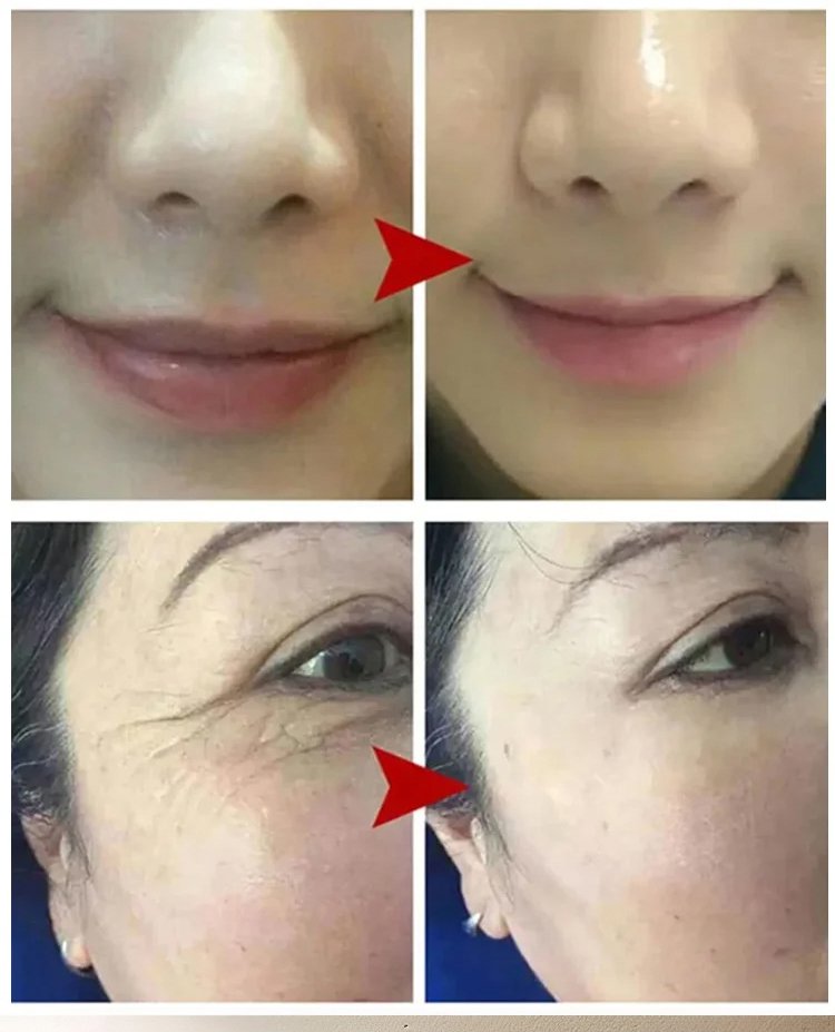 勻美博士人參精粹抗皺煥顏精華液 29 2398c666709543b98d88c8759cecbf7f63107211482421006087904TW205b6721db2a18fee5ec0564e2afcd401 勻美博士人參精粹抗皺煥顏精華液