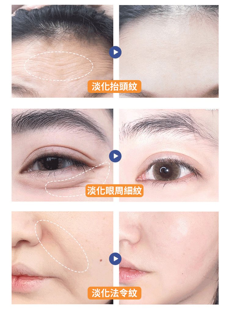 【中藥抗皺法寶】黃耆淡紋水晶眼膜貼 19 2461a2f2a28d931f9e1eb1ad83a3e5ca7011281981005473130TW24ca64cce9e6b4ee43281f65570c539c6 【中藥抗皺法寶】黃耆淡紋水晶眼膜貼