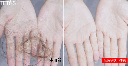 聚容防脫育髮洗髮乳 38 2f0847a96620c007abeb61809fd210b9147411451671005934663TW2a2ef406e2c2351e0b9e80029c909242d 聚容防脫育髮洗髮乳