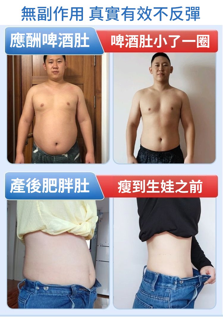 中醫健康祛濕穴位貼,楷醫生去濕穴位E型砭貼去濕驅寒溫熱敷暖貼合穴位貼6貼 中醫健康祛濕穴位貼